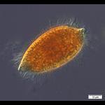 A lacrymarid ciliate