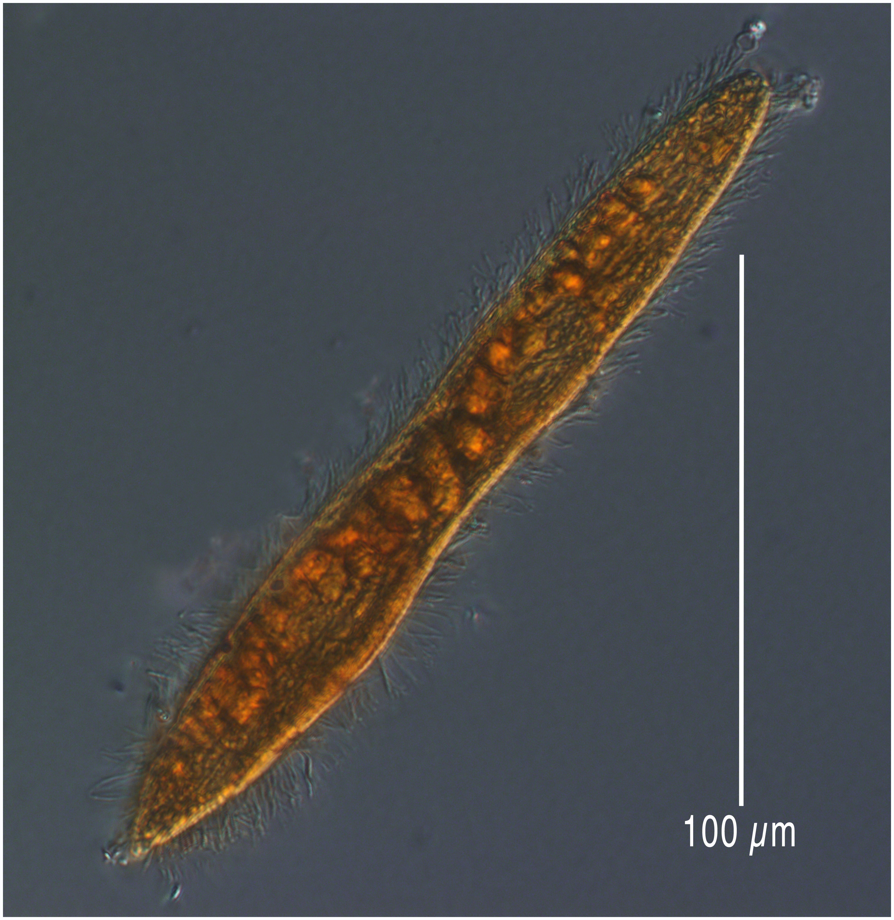 Long deep sea ciliate