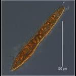 Long deep sea ciliate