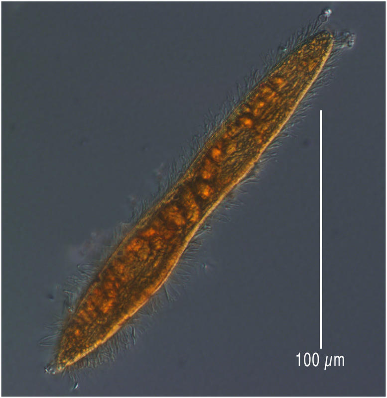 Long deep sea ciliate