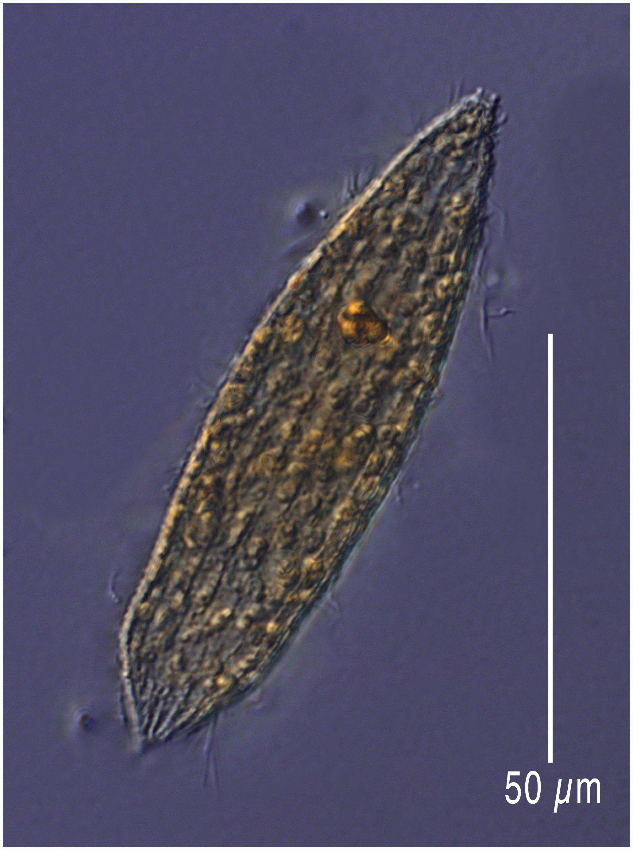 A Tiarina like ciliate