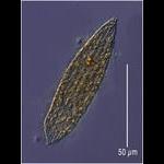 A Tiarina like ciliate