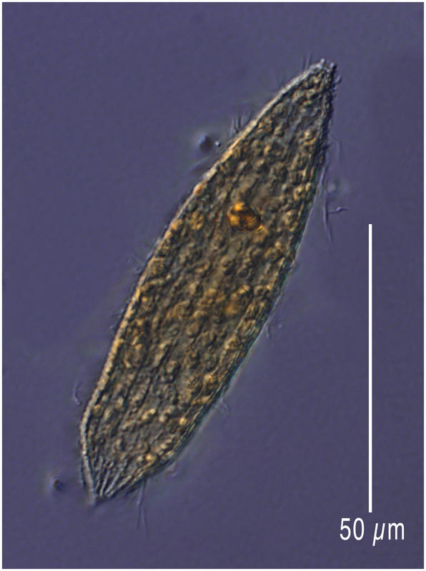 A Tiarina like ciliate