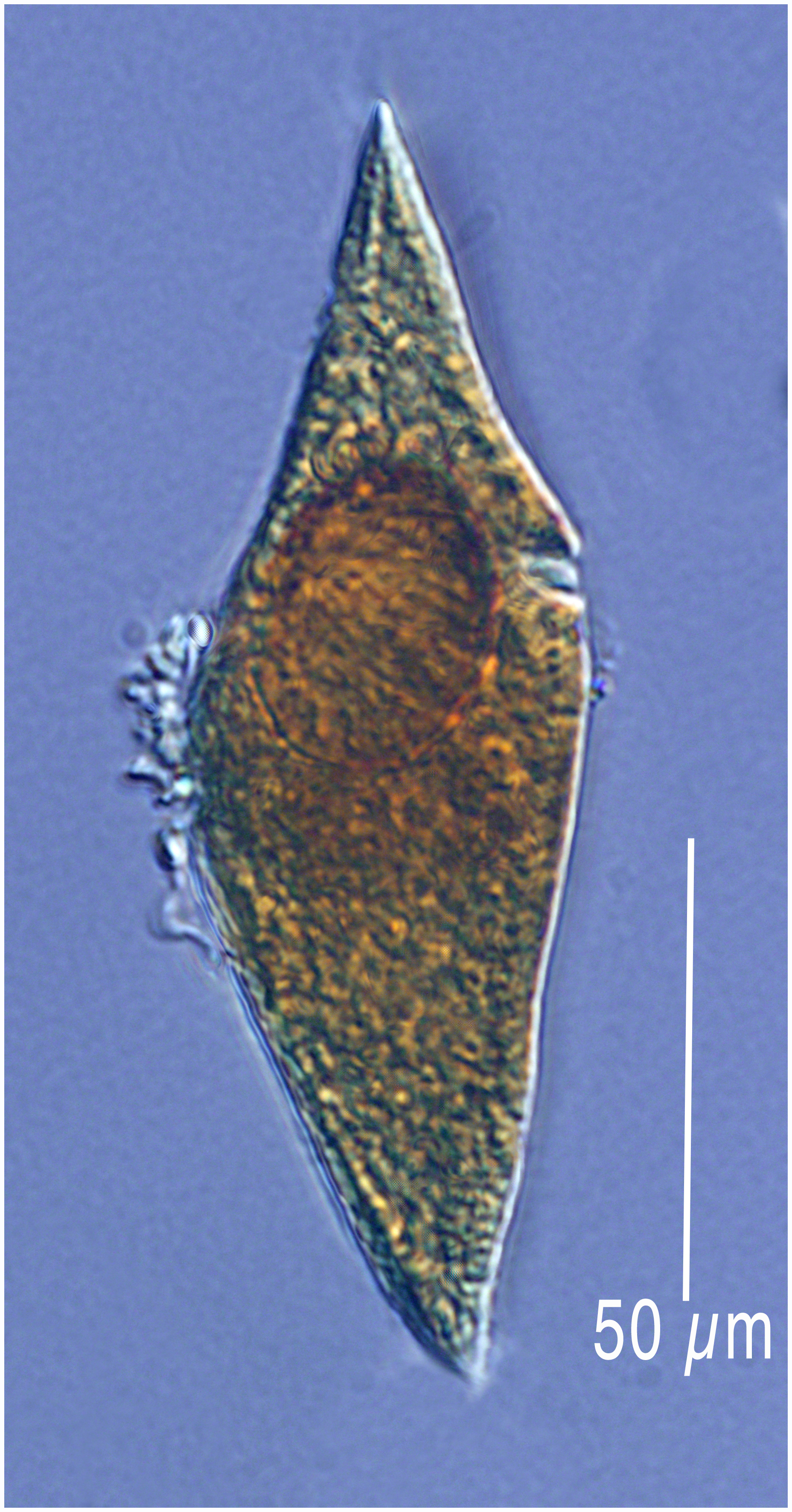 Fairly abundant (several per liter) small Gyrodinium sp.