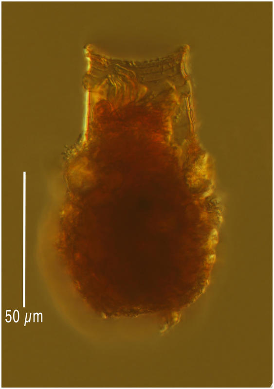 Codonellopsis morchella