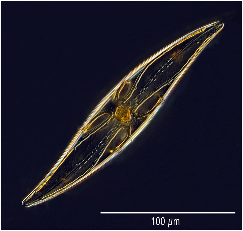 Diatom in dark waters