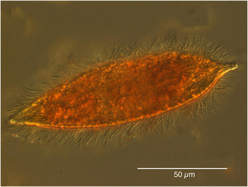 Deep Sea Ciliate