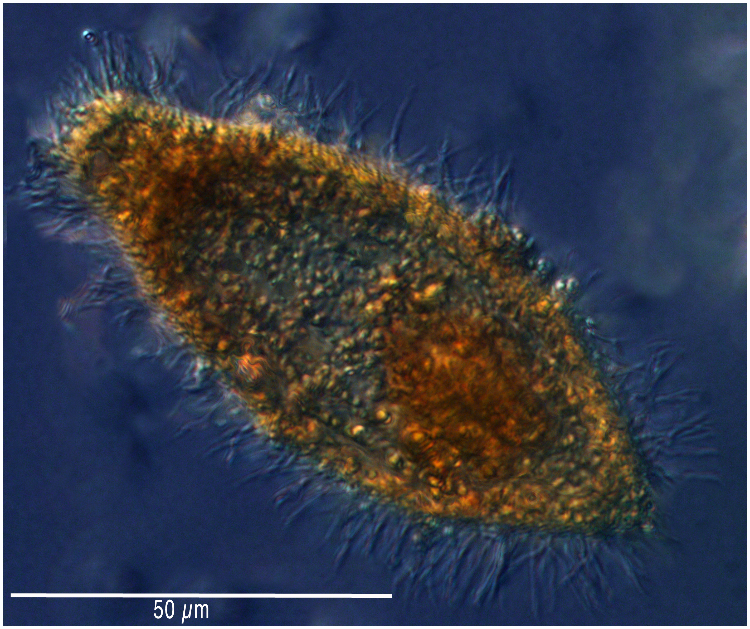 A tiarina-type ciliate