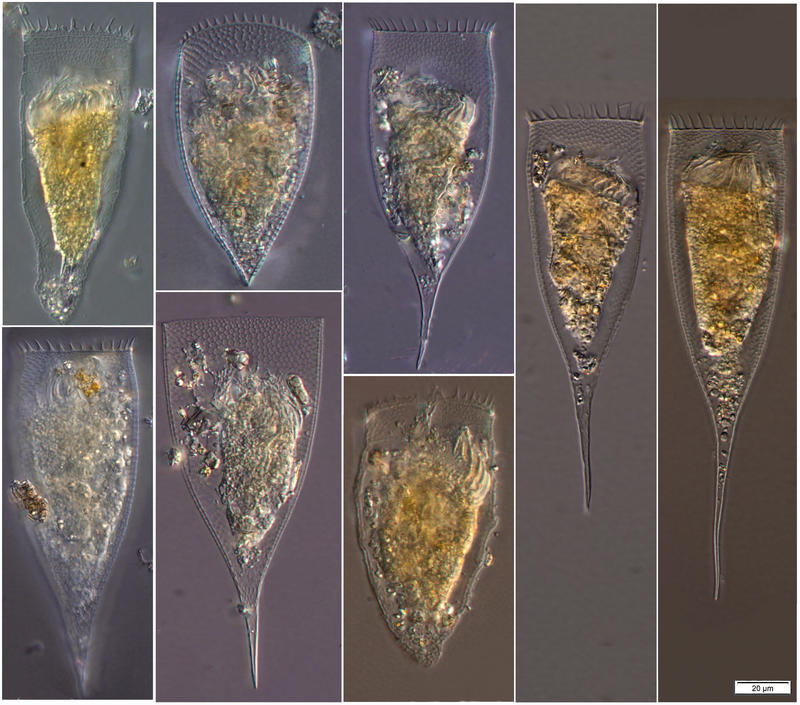 Parafavella parumdentata from a single plankton net tow in the Arctic in July 2016