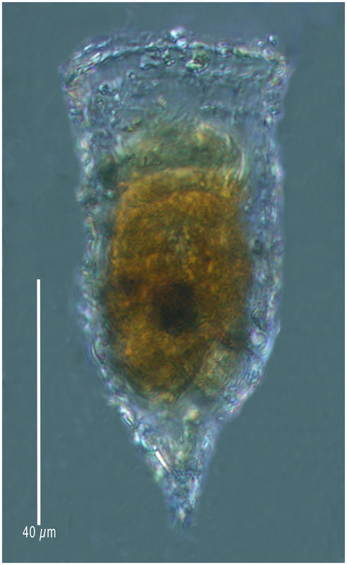 Tintinnopsis vasculum