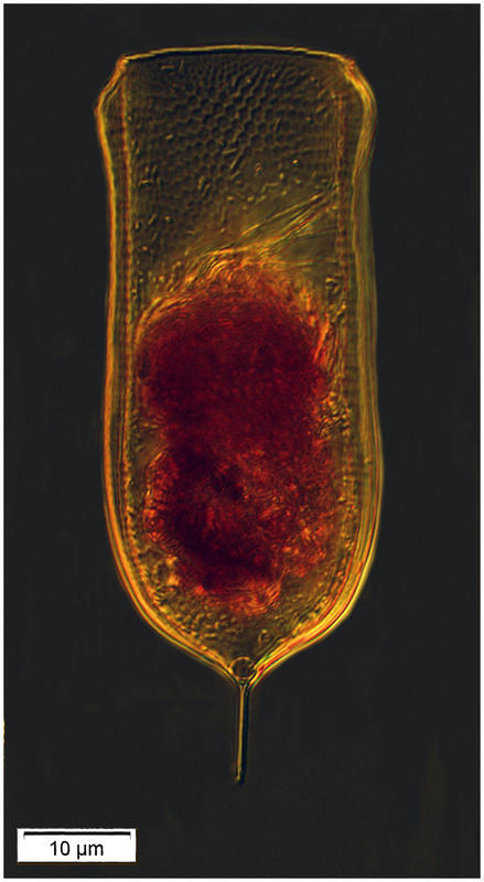 A deep water favellid- Favella aciculifera (Jörgensen 1924)