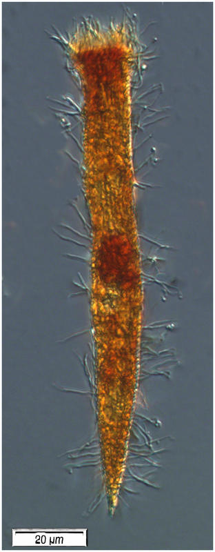 Ciliate from 250 m depth at Point C on Dec 19 2016.