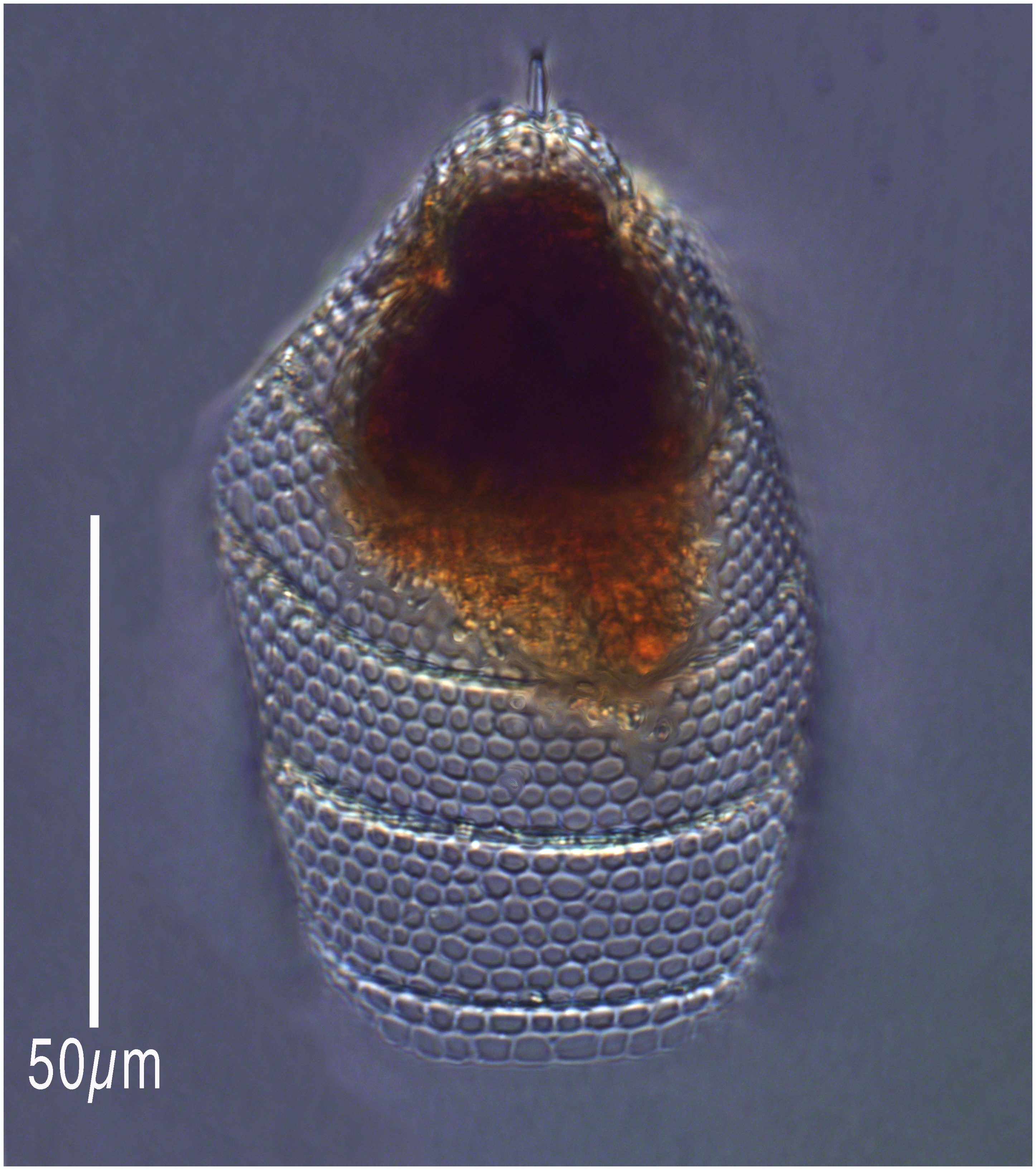 Eucyrtidium acuminatum