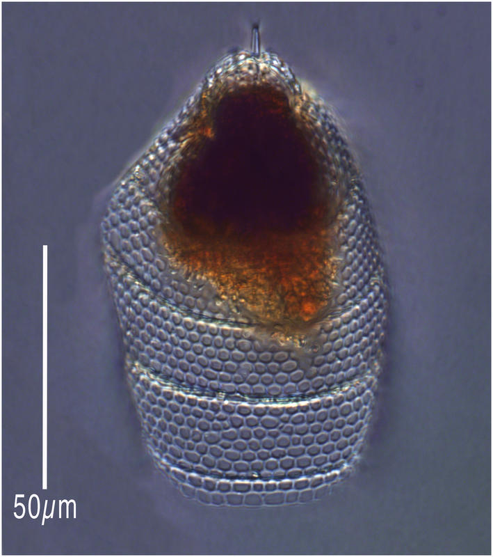 Eucyrtidium acuminatum