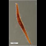 Deep Sea Ciliate