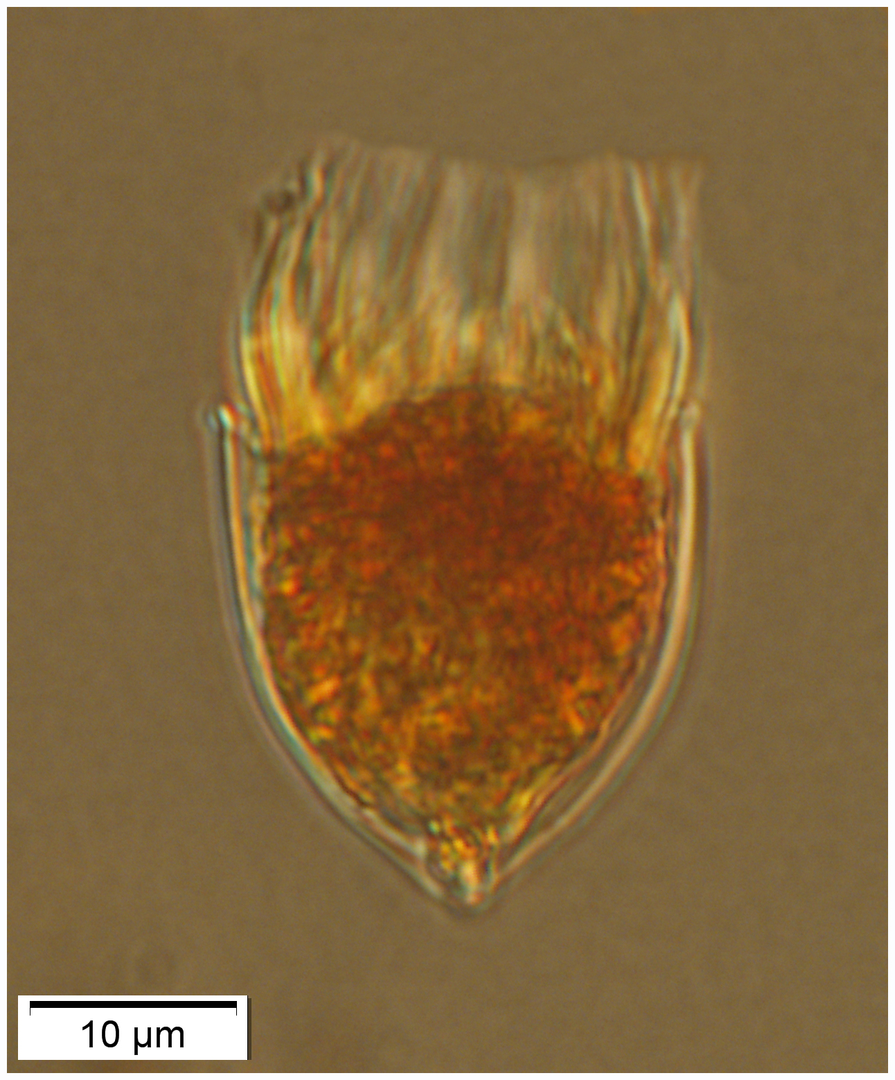 A new small Metacylis