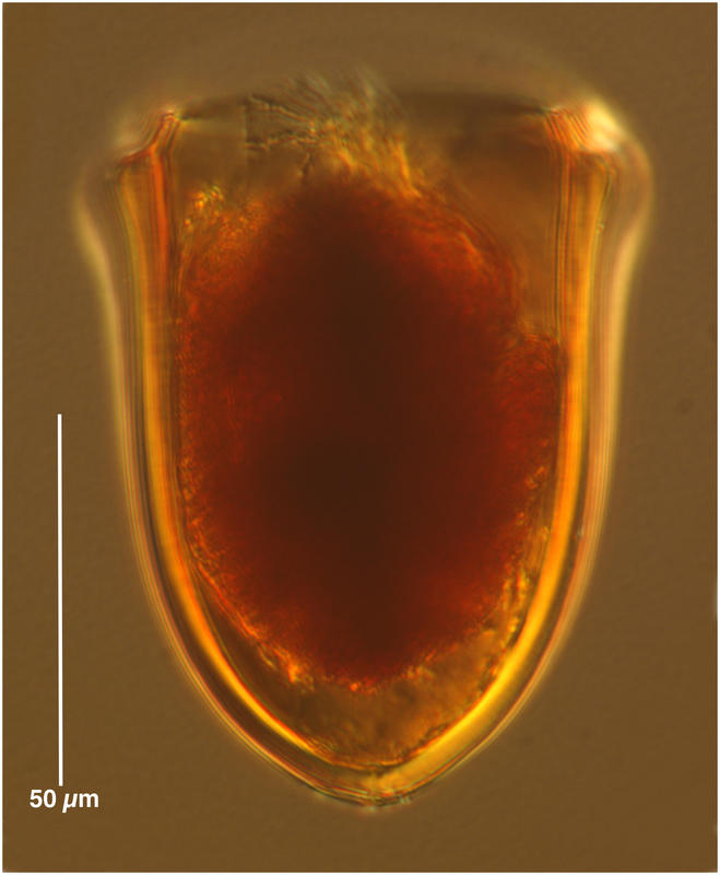 Undellopsis sp