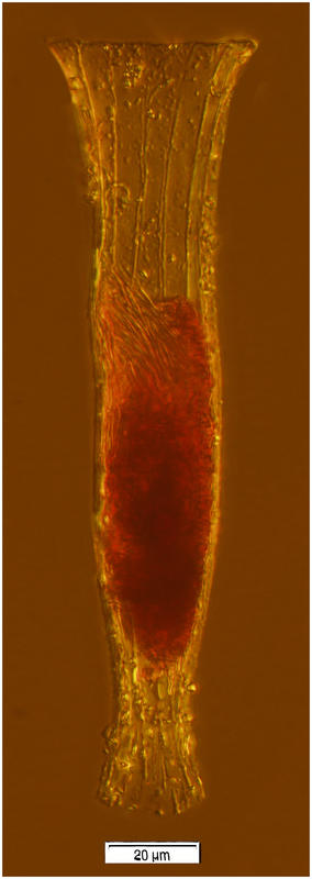 Daturella striata (Kofoid & Campbell 1929)