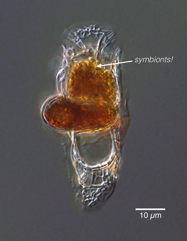 Histioneis showing symbionts