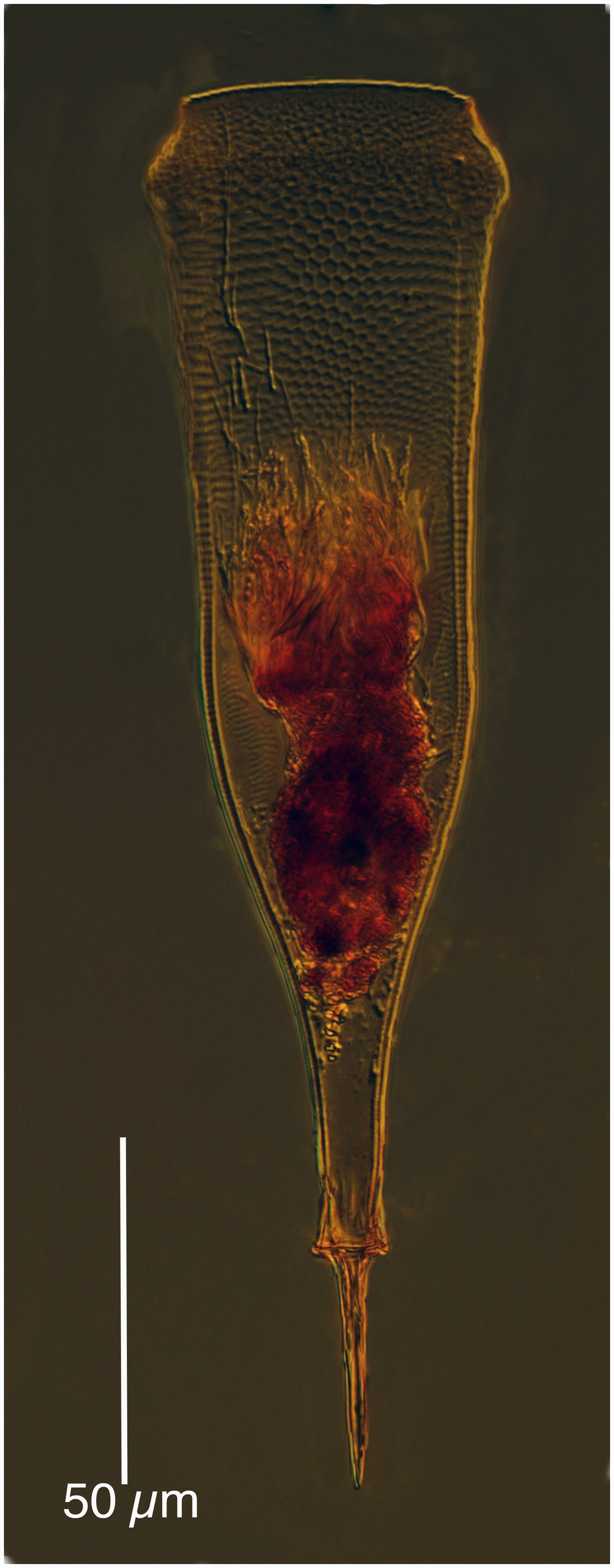 Xystonellopsis spicata