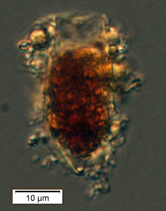 Tiny Amphorellopsis