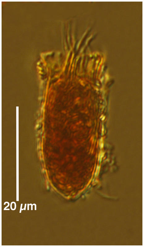 Tiny Amphorellopsis