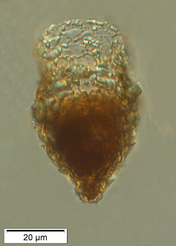 Codonellopsis lusitanica