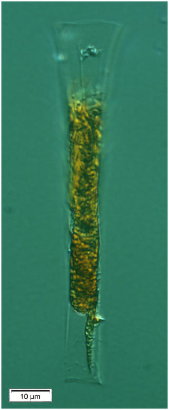 A tiny, undescribed Eutintinnus species (LOD = 17 µm)