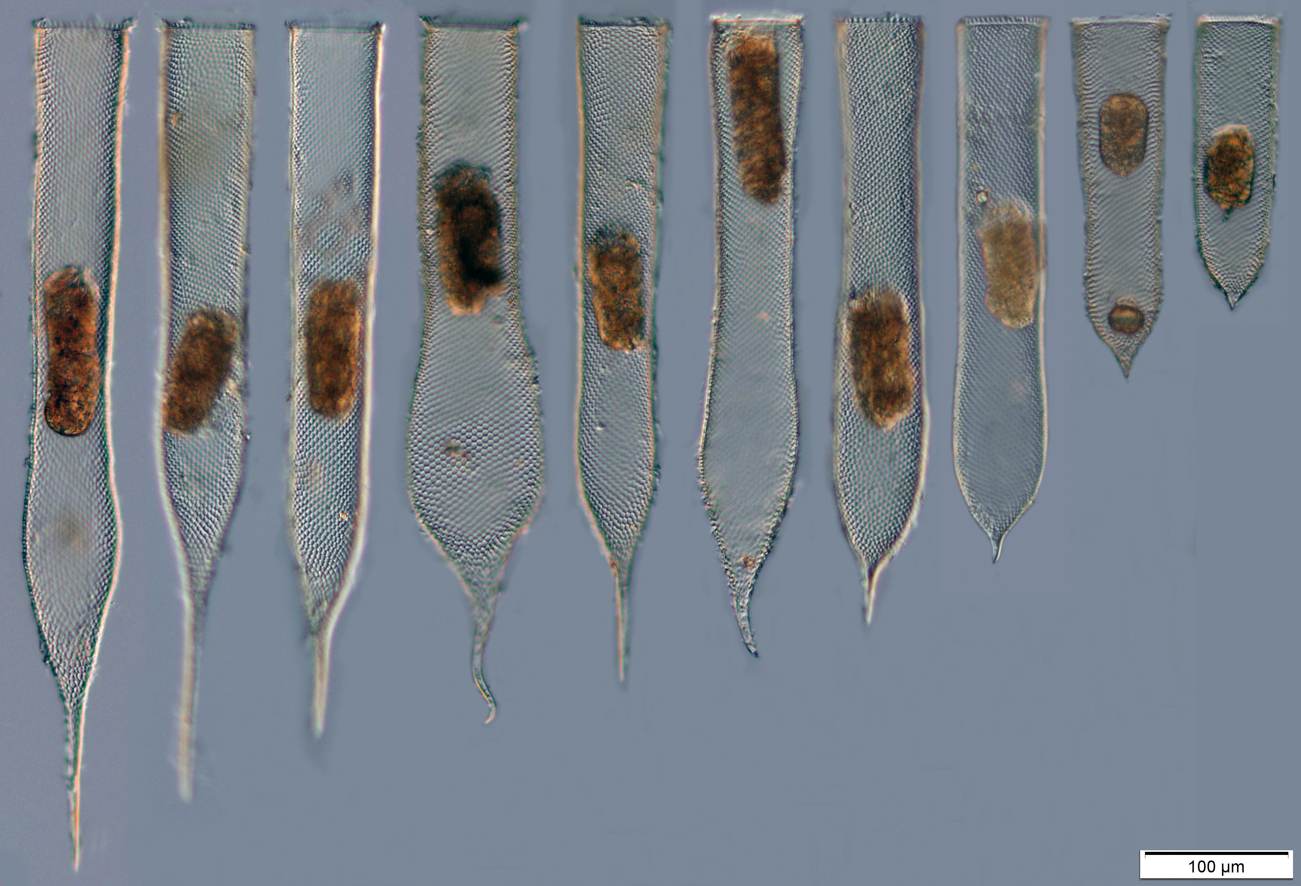 Parafavella gigantea in 2015 from a single plankton net tow at station St P1 (ARO06)