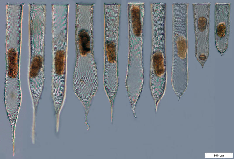 Parafavella gigantea in 2015 from a single plankton net tow at station St P1 (ARO06)