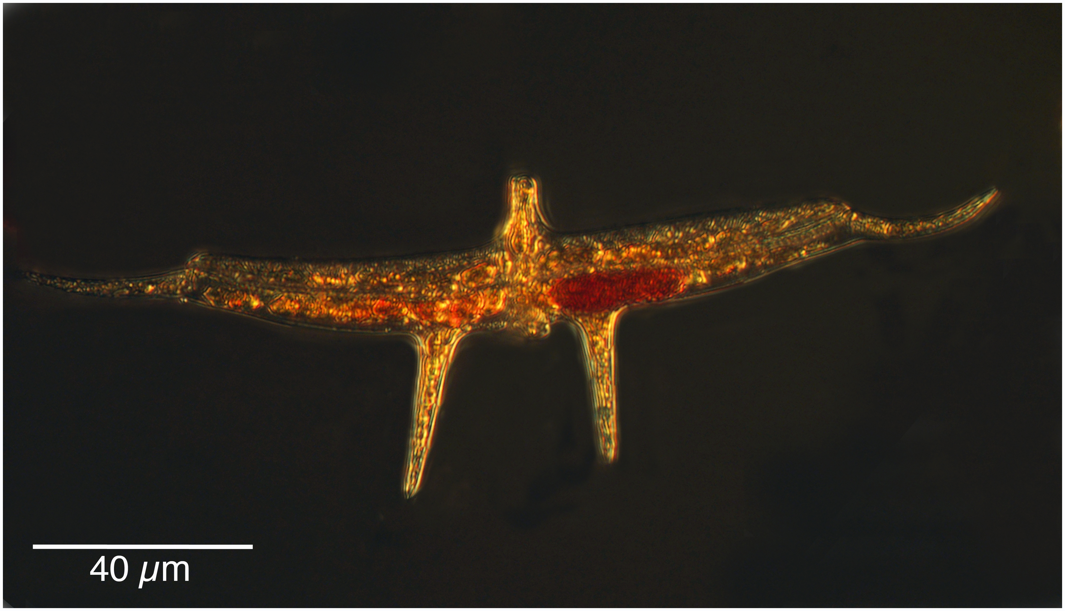 Brachidinium capitatum (F.J.R. Taylor 1963)