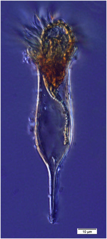 Albatrossiella agassizi