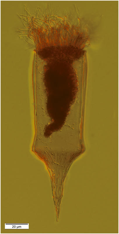 Parundella messinensis