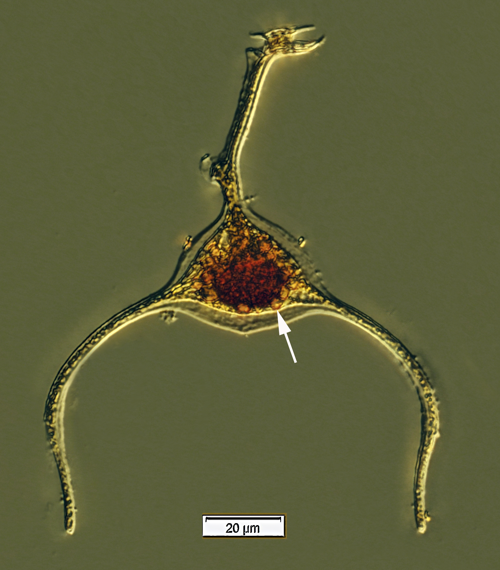 Triposolenia bicornis with endosymbionts