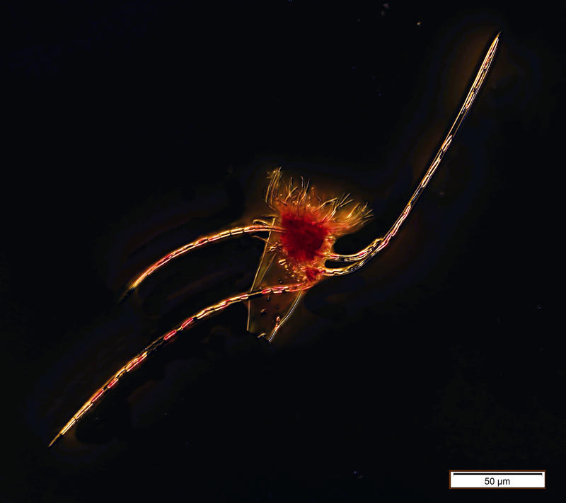 Eutintinnus apertus and its diatom Chaetoceras dadayi