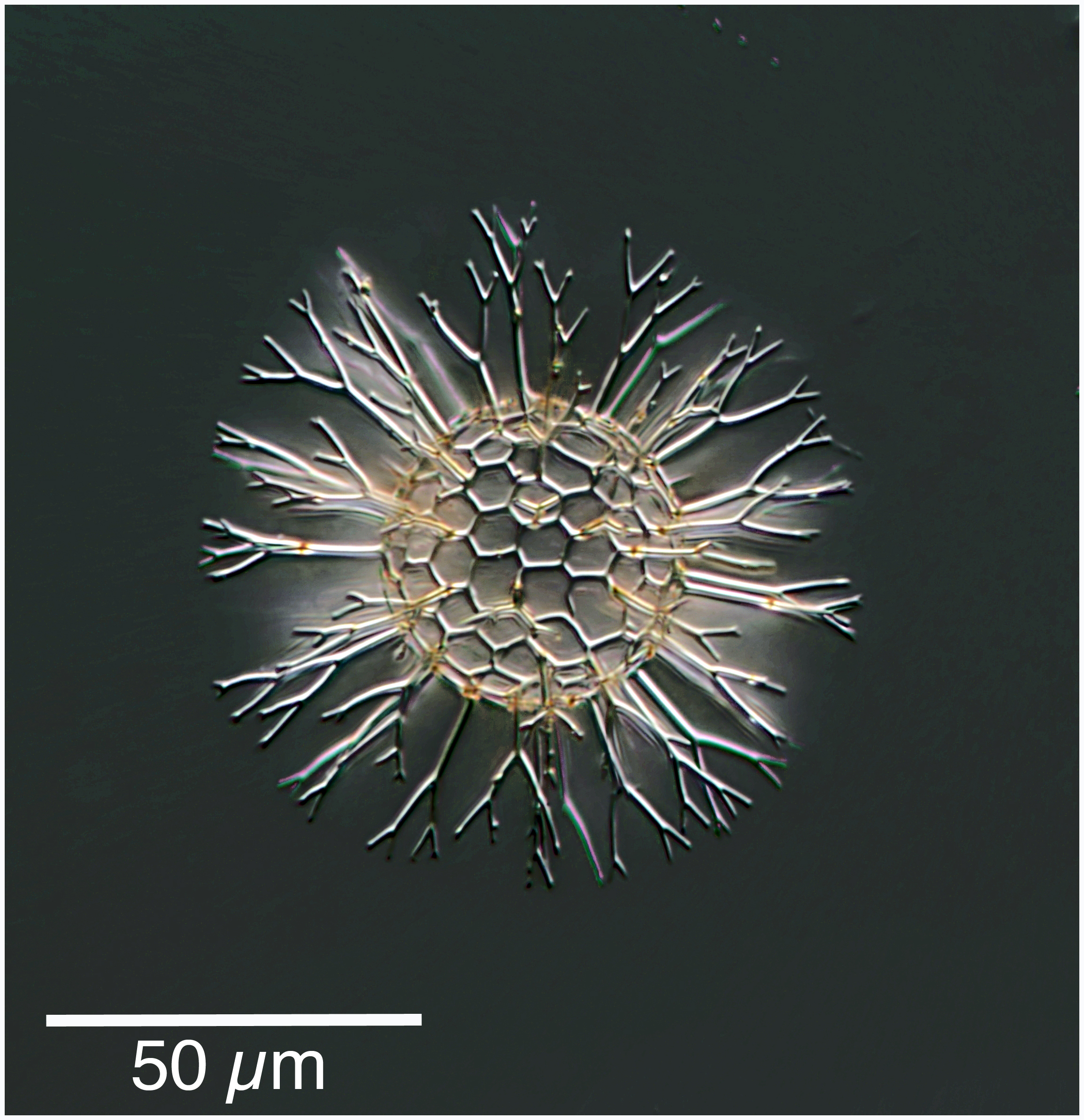 Staghorn Radiolarian : Cladococcus cervicornis (probably)