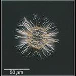 Staghorn Radiolarian : Cladococcus cervicornis (probably)