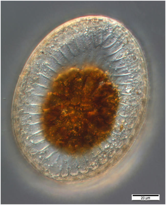 Surirella fastuosa