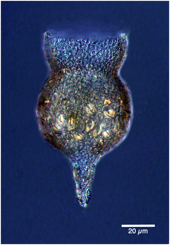 Codonella amphorella