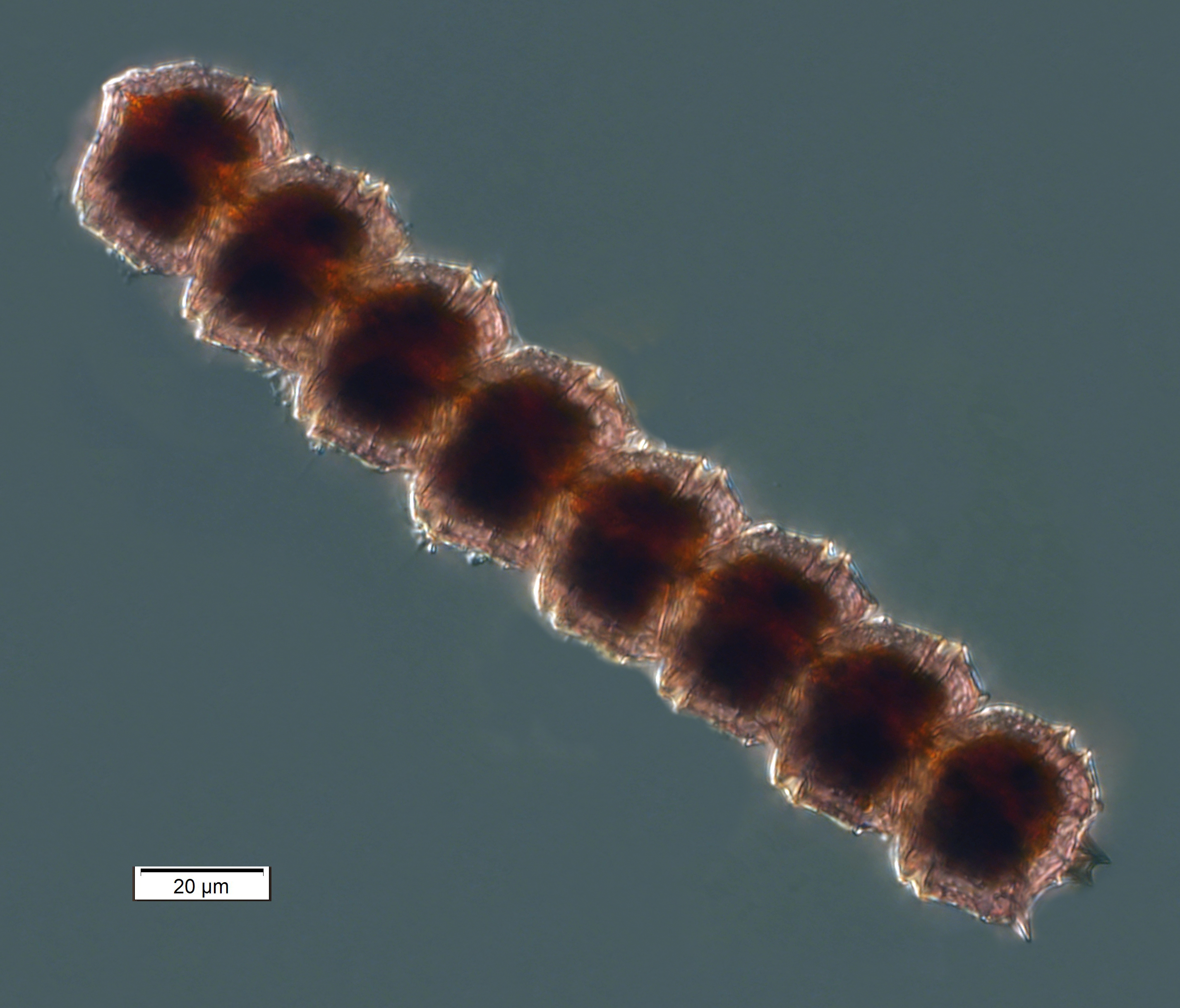 A chain of Peridiniella catenata