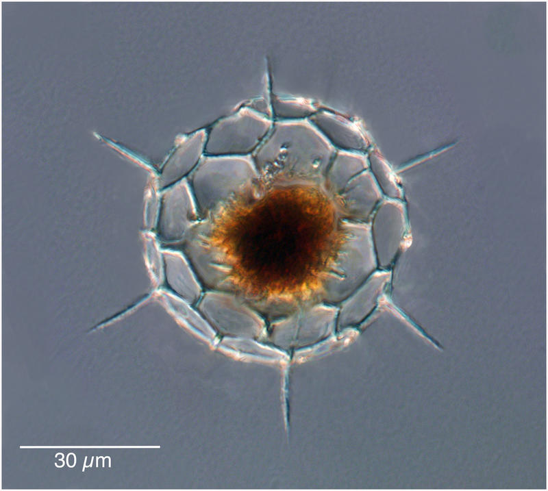 Acanthosphaera actinota (Haeckel 1860)