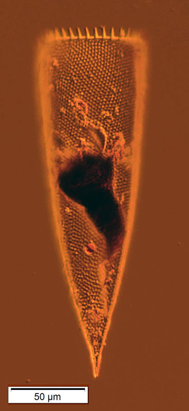 Odd Parafavella elegans morphotype (no horn)