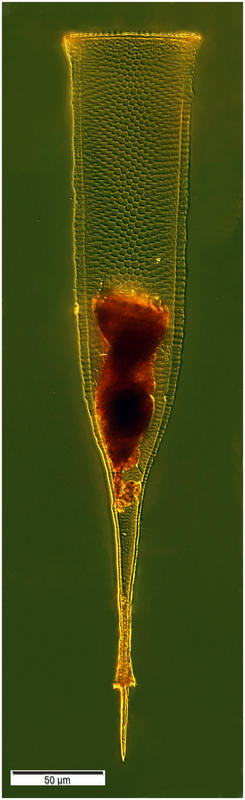 Xystonella treforti (Daday 1887)