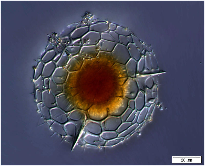 Probably an immature specimen of Hexacontium pachydermum Jorgensen 1900