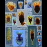 Diversity of Planktonic Ciliates in the Bay of Villefranche