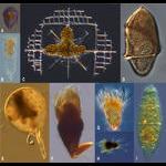 Microzooplankton of Villefranche