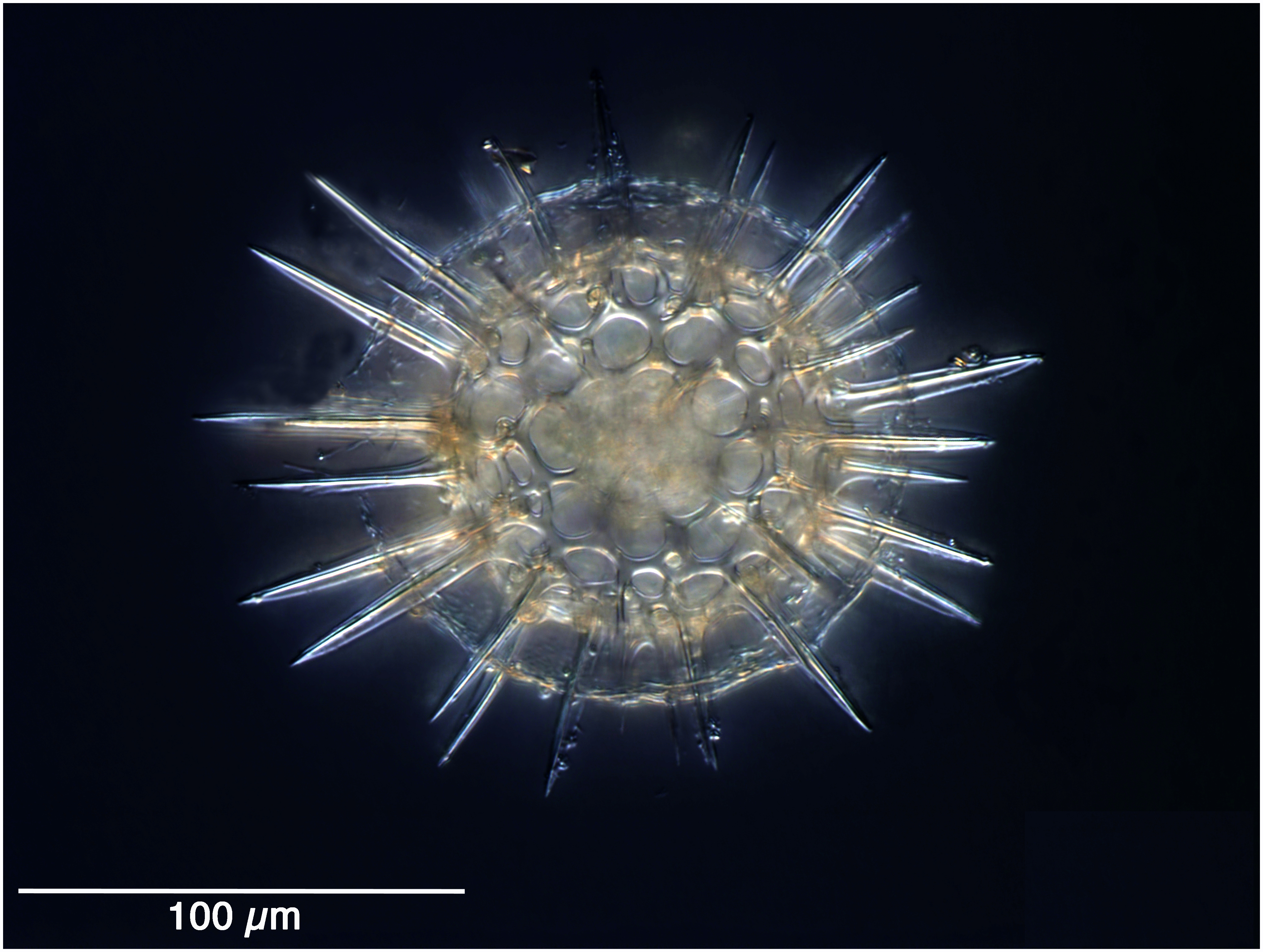 Actinomma trinacrium (Haeckel 1887)