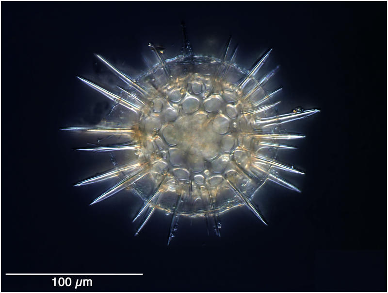 Actinomma trinacrium (Haeckel 1887)