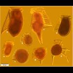 Dinophysid Dinoflagellate Diversity in a Single Sample