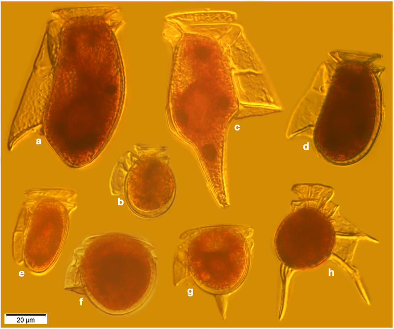 Dinophysid Dinoflagellate Diversity in a Single Sample